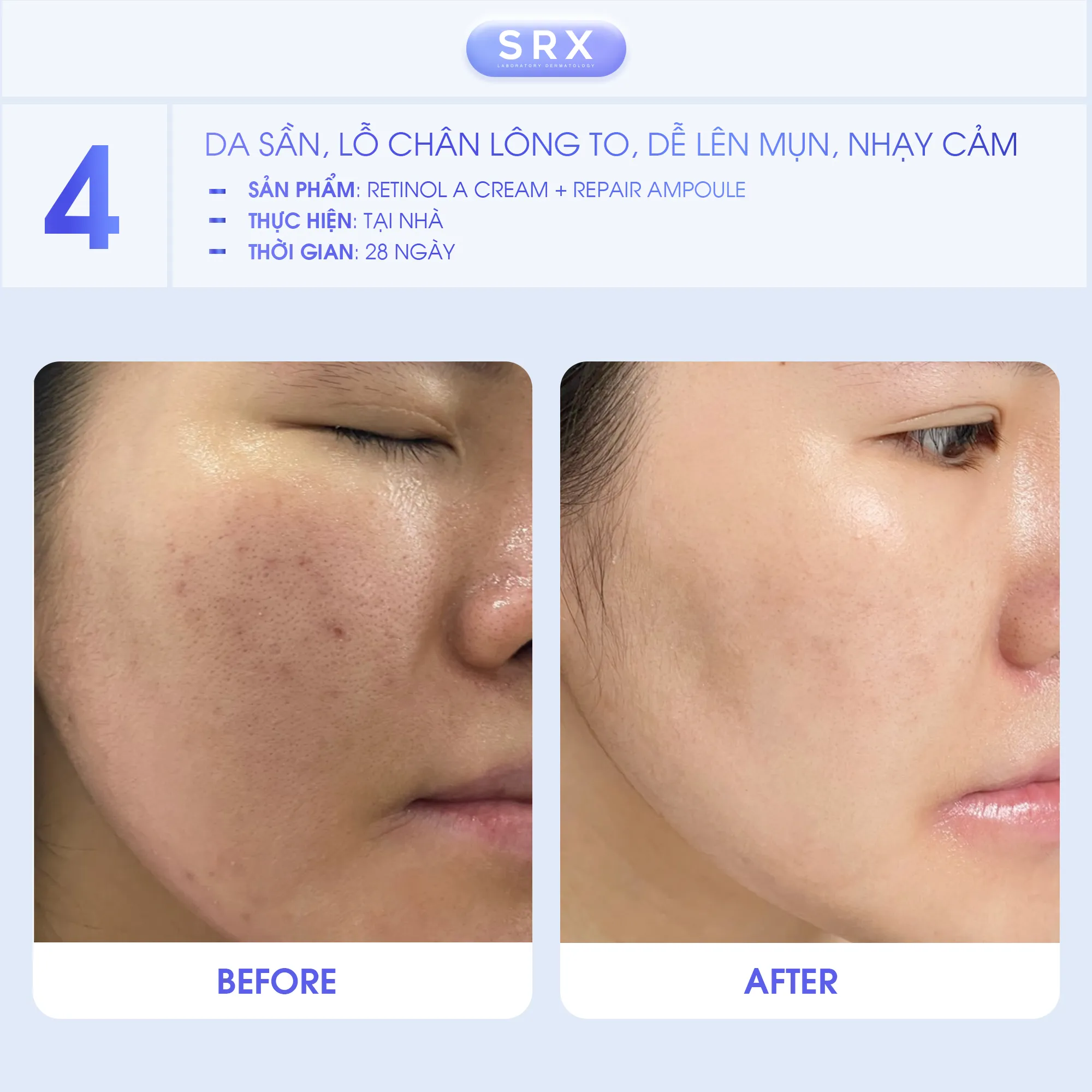 Feedback SRX Case lâm sàng điều trị các vấn đề trên da cùng bộ sản phẩm SRX 6