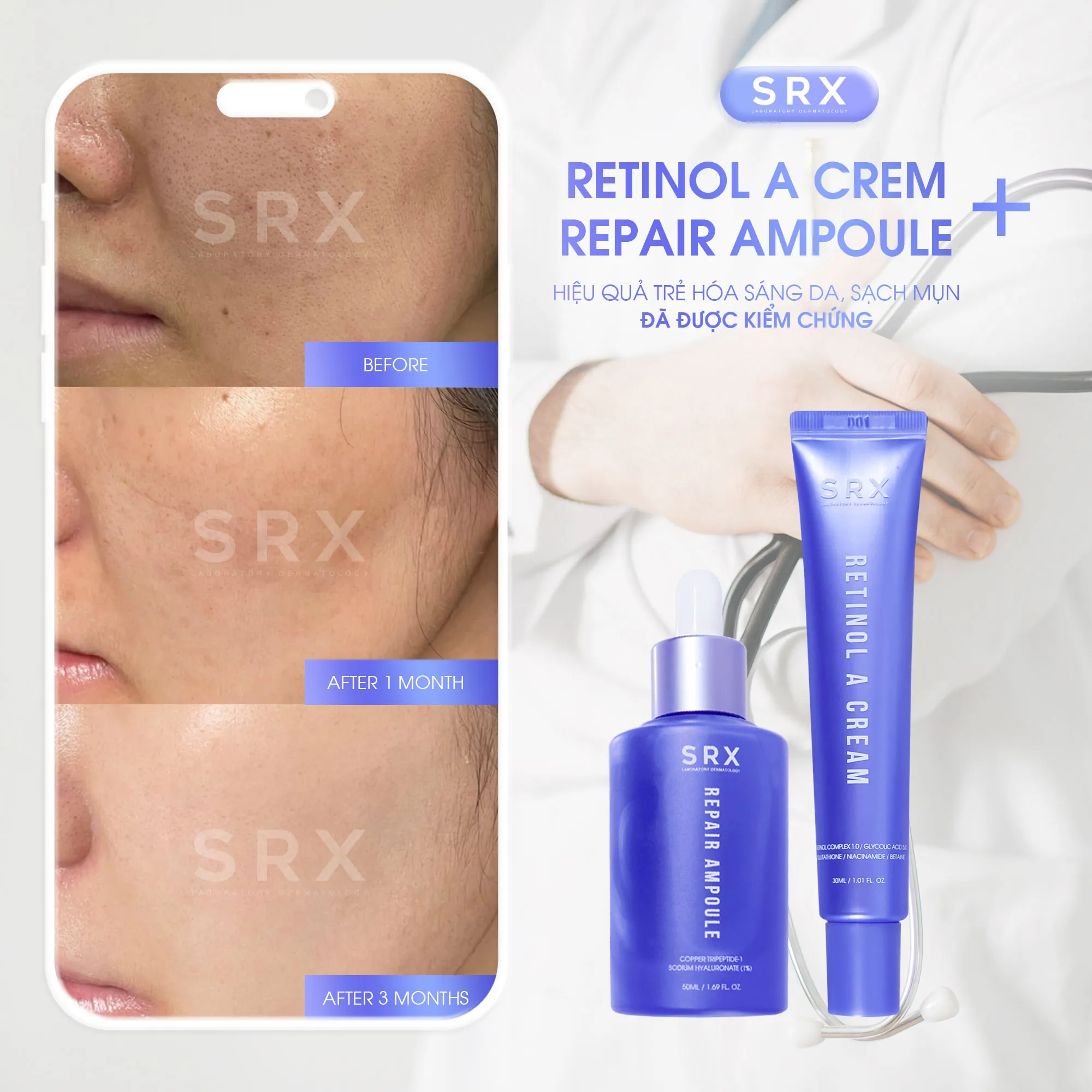 Feedback SRX Hiệu quả trẻ hóa sáng da, sạch mụn từ Retinol A Crem + Repair Ampoule đã được kiểm chứng