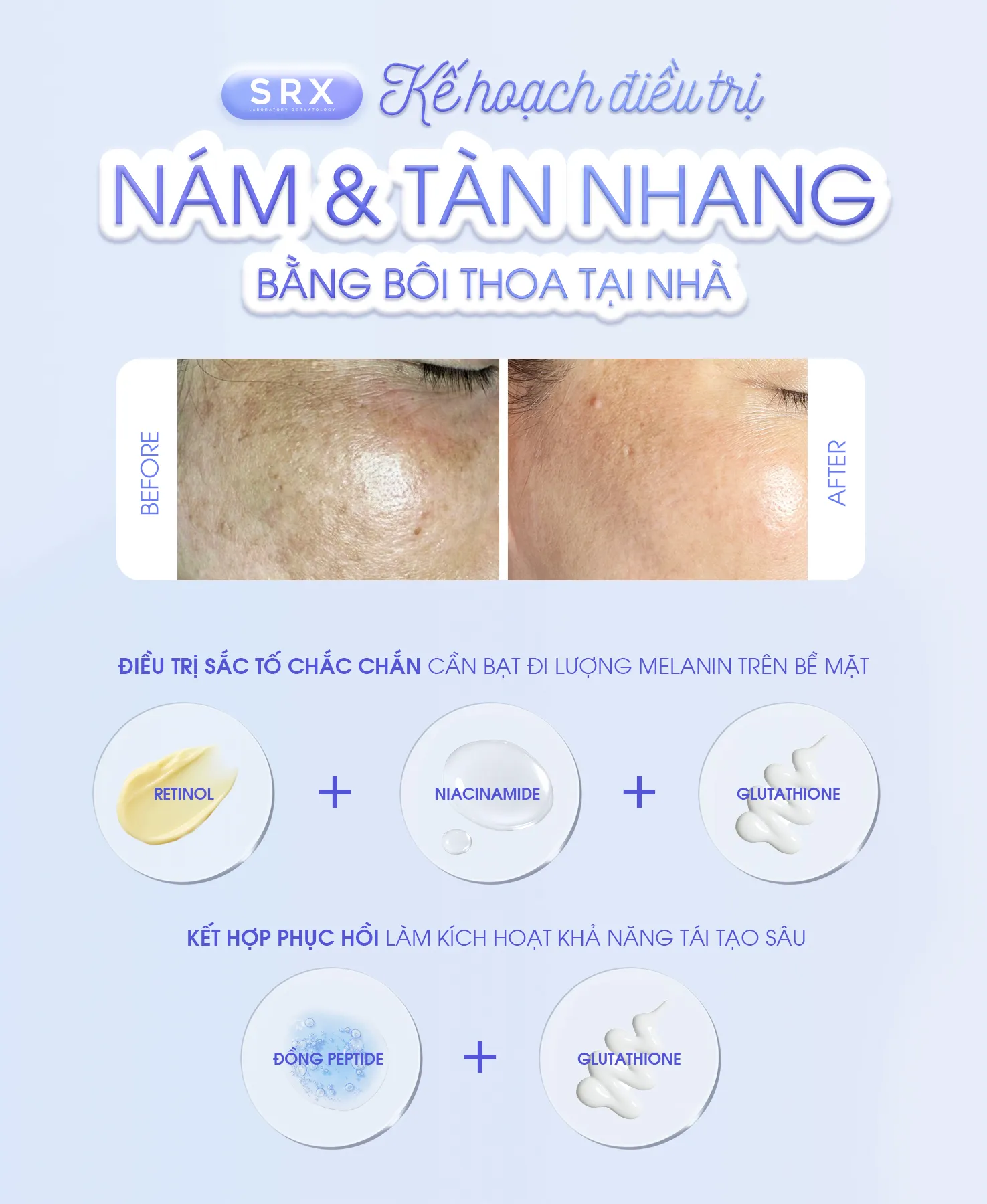Feedback SRX KẾ HOẠCH ĐIỀU TRỊ NÁM & TÀN NHANG BẰNG BÔI THOA TẠI NH