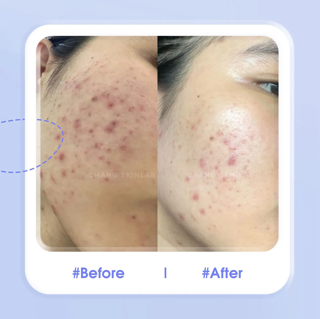 Feedback SRX RETINOL A CREAM và NHỮNG HÌNH ẢNH BIẾT NÓI 3